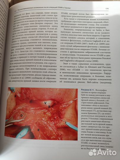Пескатори Марио Аноректальная хирургия