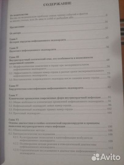 Хирургическое лечение инфекционного эндокардита