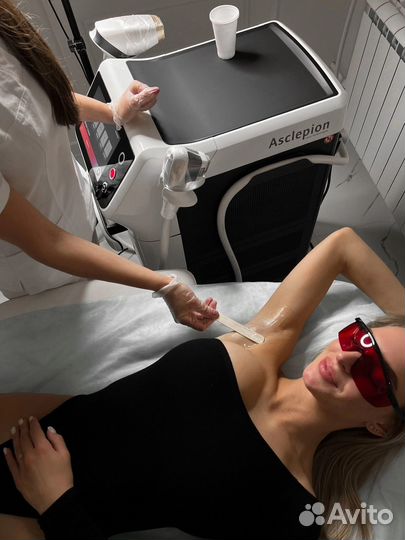 Лазерная эпиляция