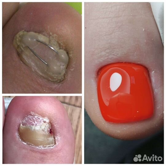 Педикюр/маникюр с выездом на дом любой сложности