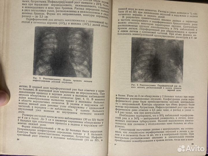Рентгенодиагностика медицинские книги рентген