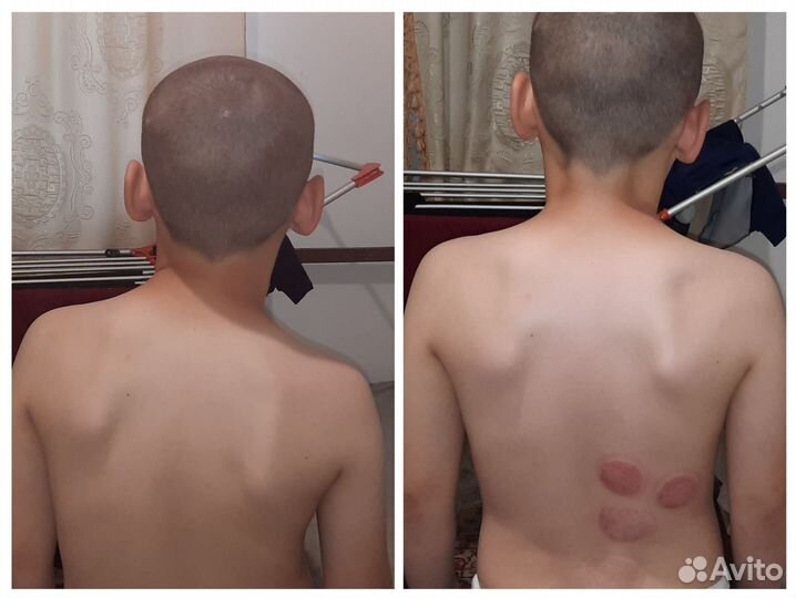 Массаж на дому