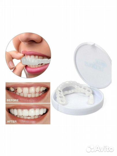 Виниры для зубов Накладные зубы