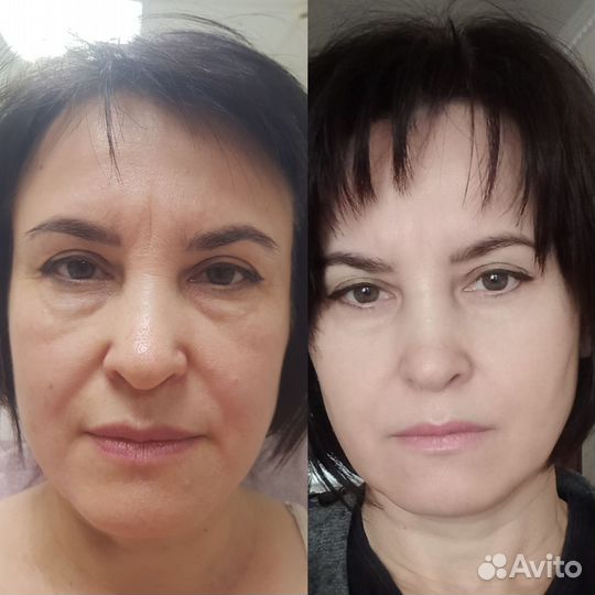 Холодная Плазма
