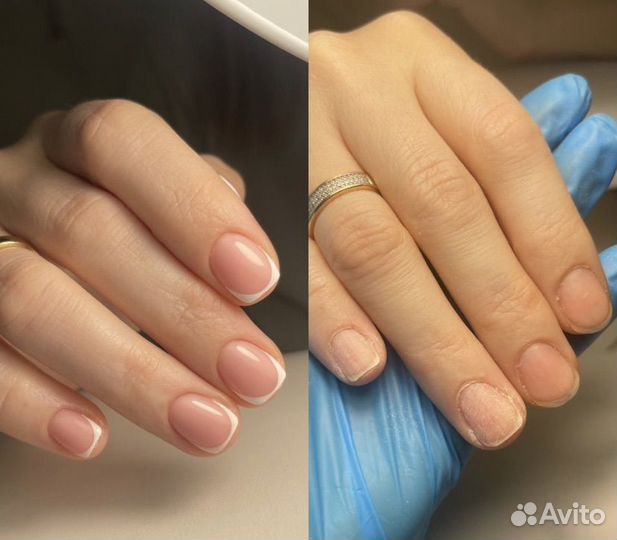 Наращивание ногтей