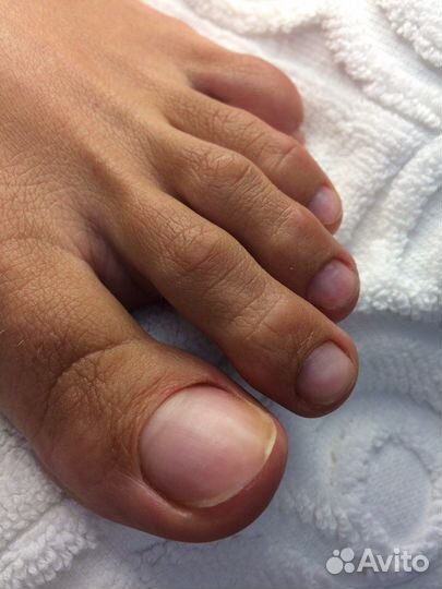 Медицинский аппаратный педикюр