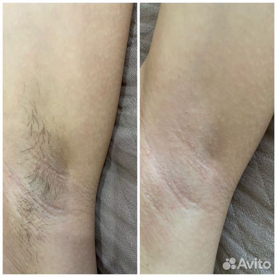 Мастер шугаринга и депиляции