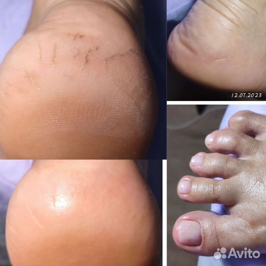 Маникюр педикюр на дому