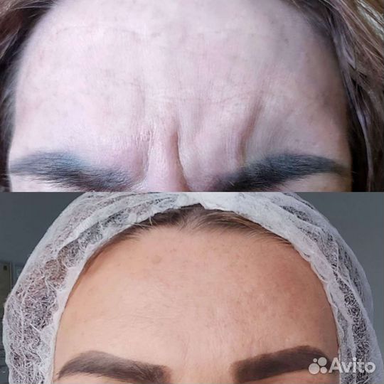 Услуги косметолога