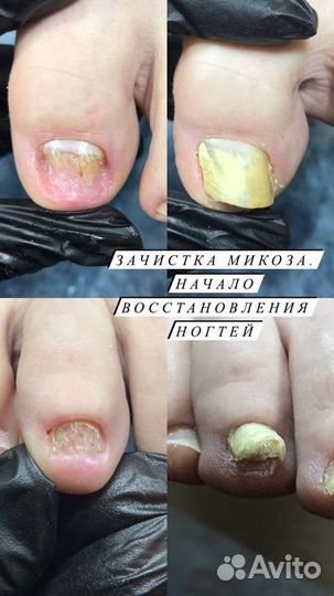 Маникюр, педикюр, подология