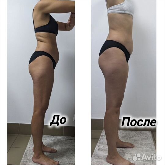 Антицеллюлитный массаж