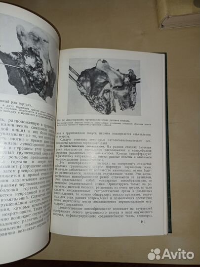 Злокачественные опухоли полости рта. Пачес. 1988