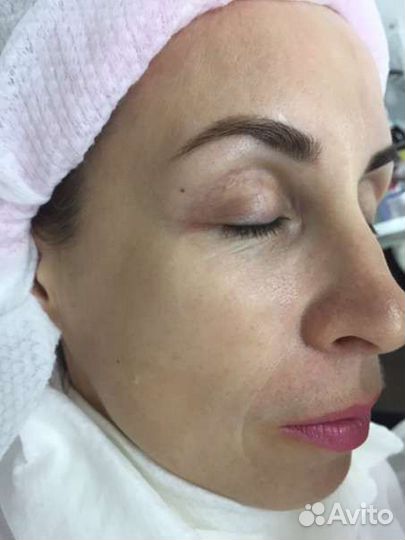 Скульптурный массаж лица