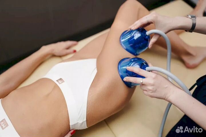 Lpg-аппарат. Оригинал