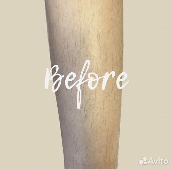 Депиляция воском