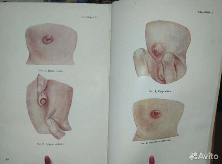 Физиология и патология детей(младенцев)медгиз 1955
