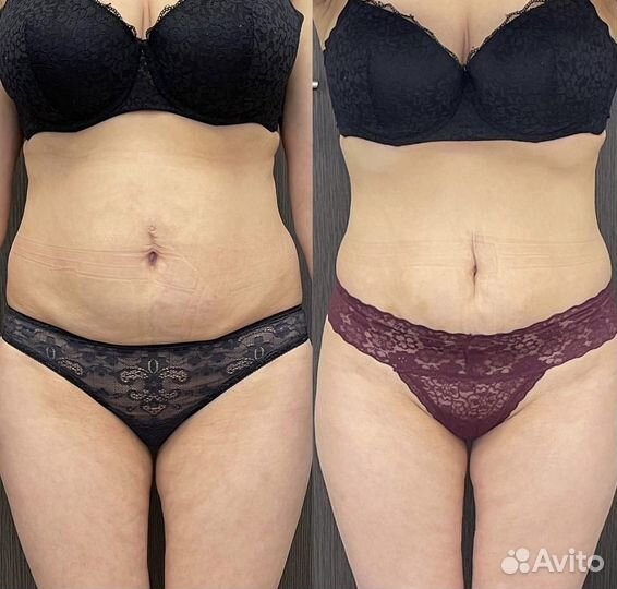 Липолитик, точка голода