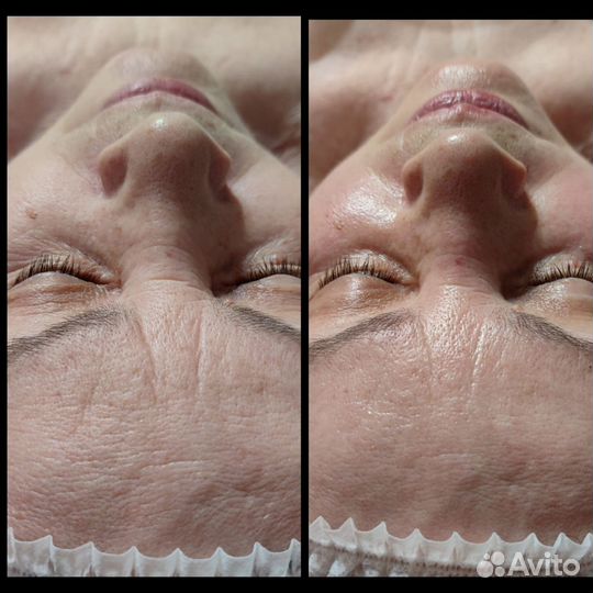 Массаж лица