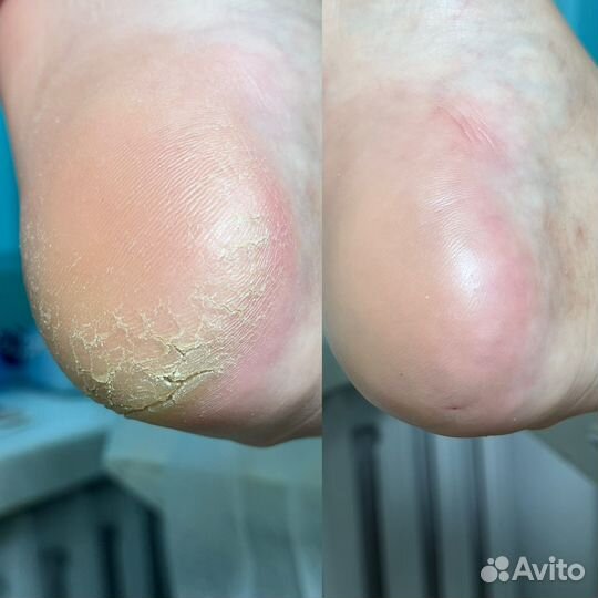 Маникюр, педикюр