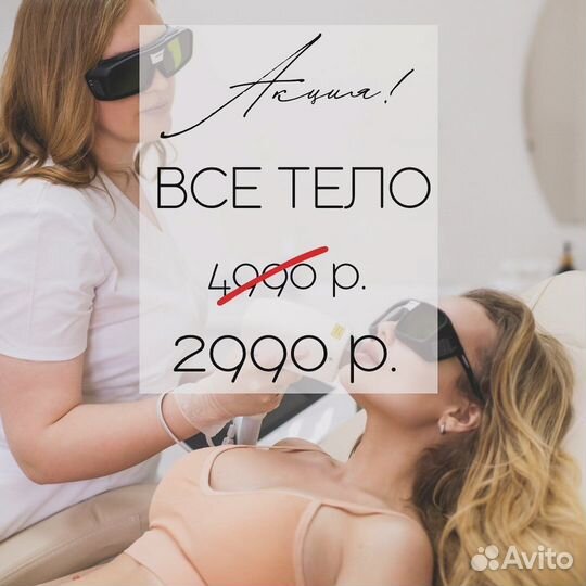 Лазерная эпиляция