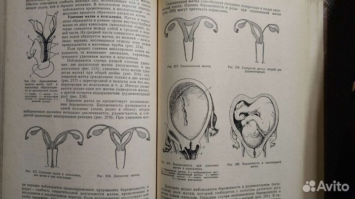 Учебник акушерство