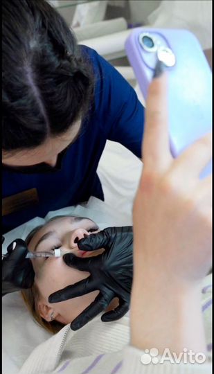 Увеличение губ. Без боли