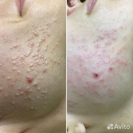 Косметолог с мед. образованием