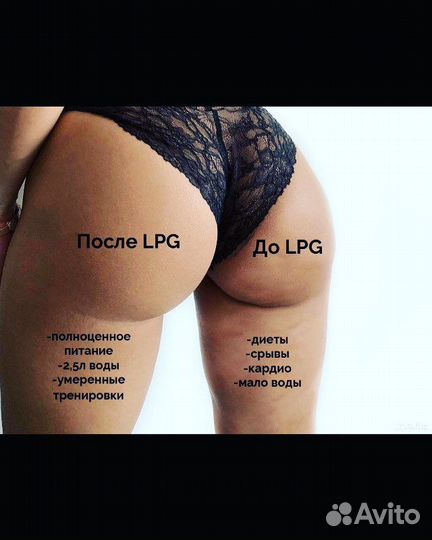Аппаратный массаж LPG