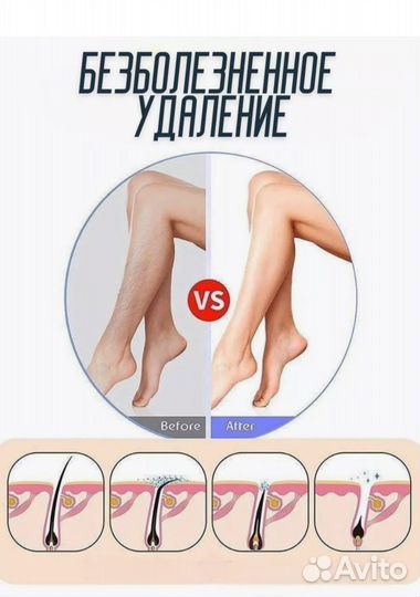 Эпилятор ручной 