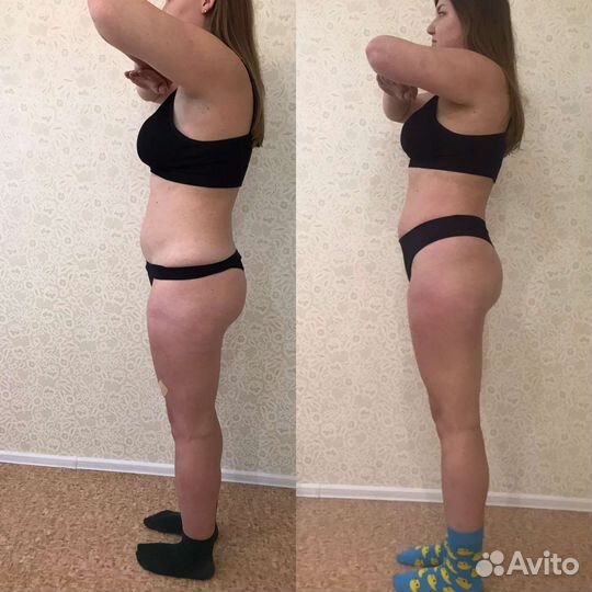 Кавитация, антицеллюлитный массаж,рф лифтинг