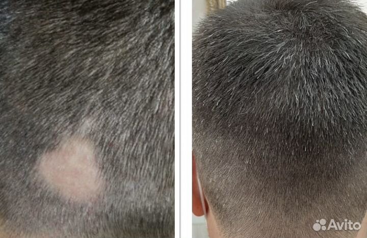 Накладки из натуральных волос имитация кожи