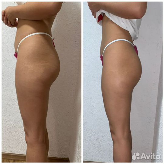 Коррекция фигуры