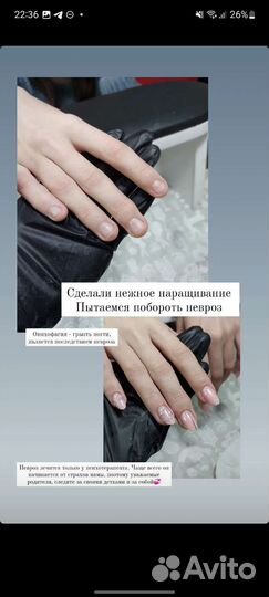 Маникюр Наращивание Восстановление формы