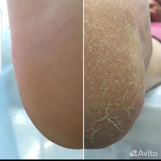 Маникюр педикюр все сложности покрытие гельлаком