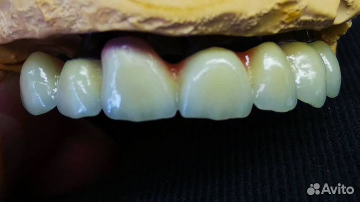 Услуги зубного техника