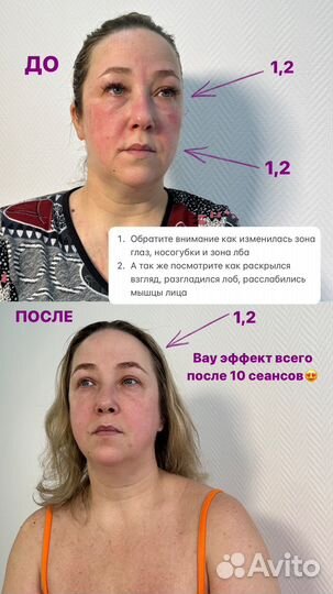 SPA массаж лица и омоложение лица