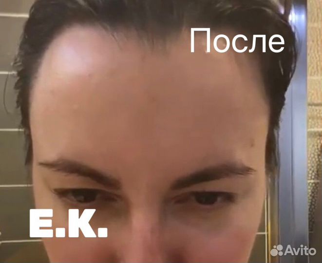 Услуги косметолога