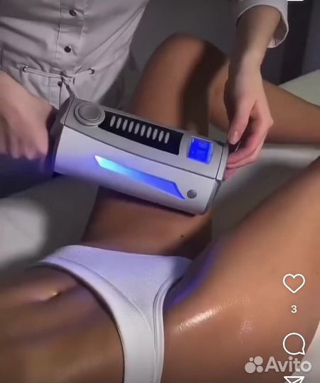 Коррекция фигуры (сфератерапия,EMC, криолиполиз)