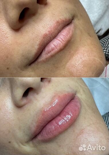 Косметолог, чистка лица, подбор домашнего ухода