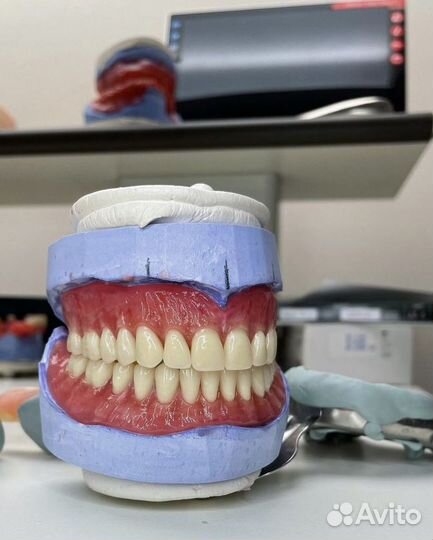 Зубной техник Реставрация и изготовления протезов