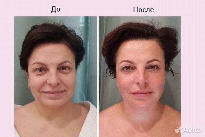 Скульптурный массаж лица