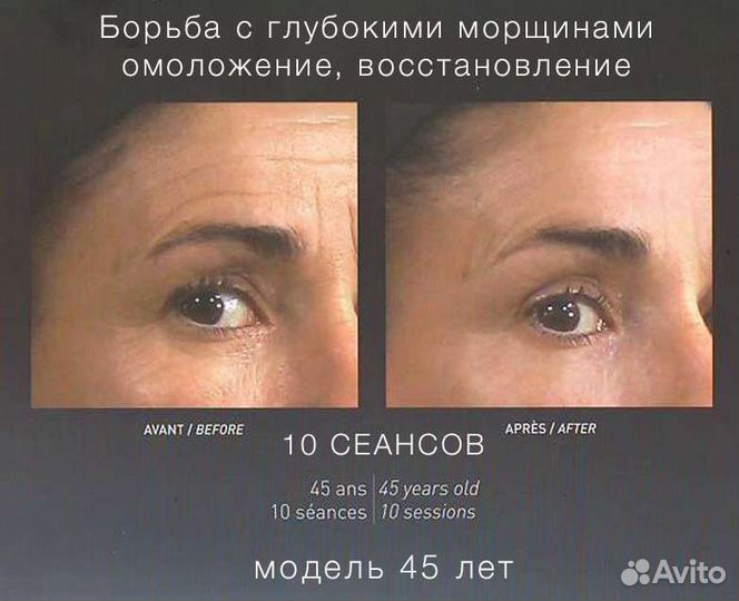 Аренда LPG аппаратов для массажа. LPG Keymodule