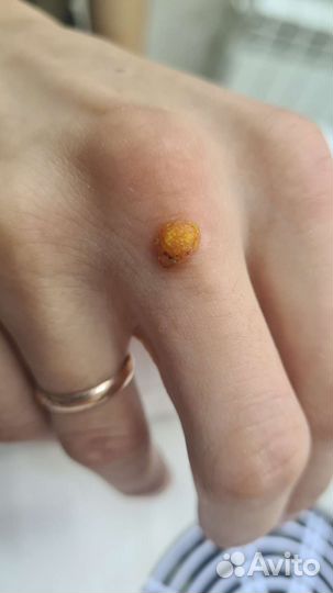 Подология И эстетика