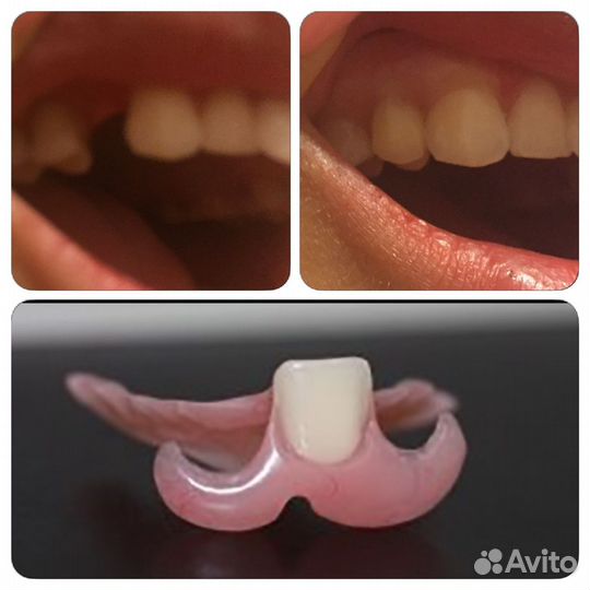 Услуги зубного техника