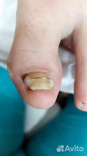 Подолог/специалист по педикюру