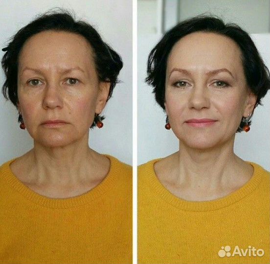 Минус 5-10 лет лицо-шея-декольте за курс