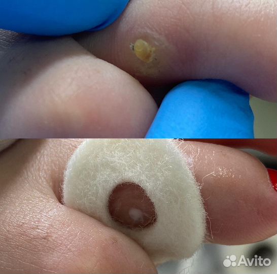 Услуги подолога