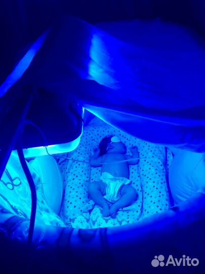 Лампа от желтушки