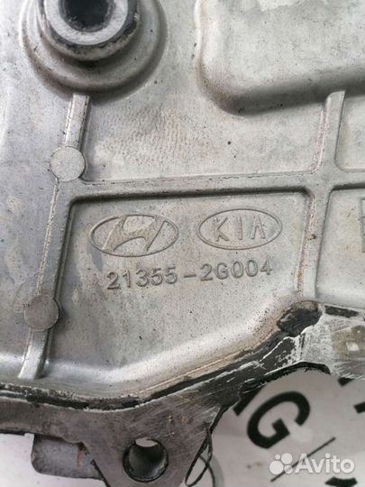 Крышка цепи грм Hyundai Hyundai Sonata 6 YF