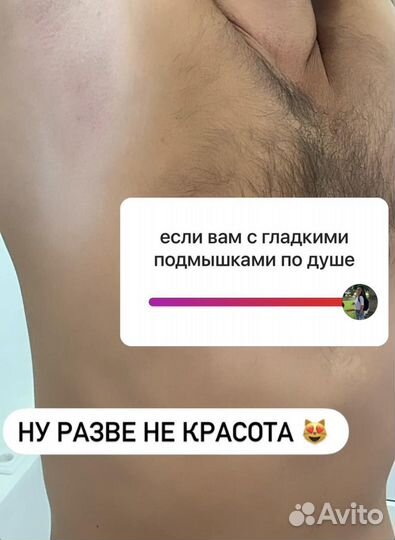 Шугаринг,депиляция воском